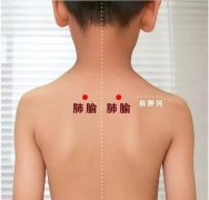 小兒推拿培訓小兒推拿手法應該注意哪些事項？